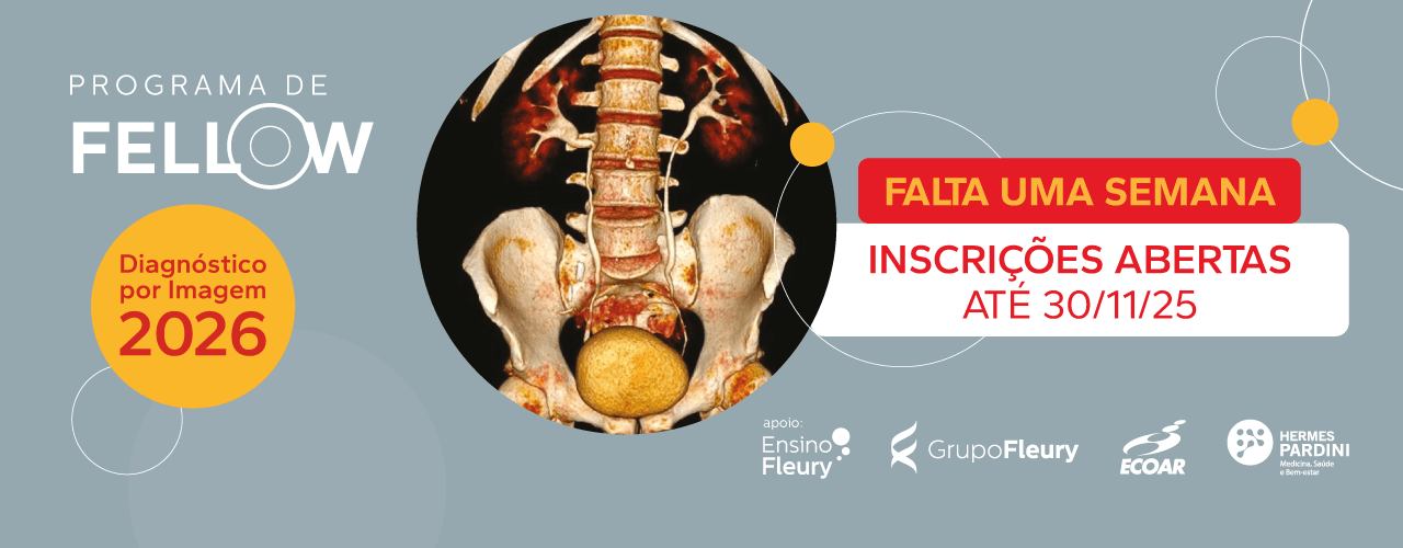 1280x500px_BannerDesktop_ProgramaFellowMG_FaltaUmaSemana (1).png